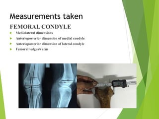 Measurements taken
FEMORAL CONDYLE
! Mediolateral dimensions
! Anterioposterior dimension of medial condyle
! Anterioposterior dimension of lateral condyle
! Femoral valgus/varus
 