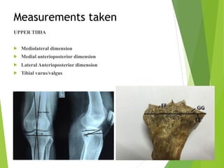 Measurements taken
UPPER TIBIA
! Mediolateral dimension
! Medial anterioposterior dimension
! Lateral Anterioposterior dimension
! Tibial varus/valgus
 