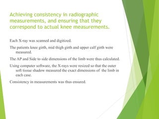 Achieving consistency in radiographic
measurements, and ensuring that they
correspond to actual knee measurements.
Each X-ray was scanned and digitized.
The patients knee girth, mid thigh girth and upper calf girth were
measured.
The AP and Side to side dimensions of the limb were thus calculated.
Using computer software, the X-rays were resized so that the outer
soft tissue shadow measured the exact dimensions of the limb in
each case.
Consistency in measurements was thus ensured.
 