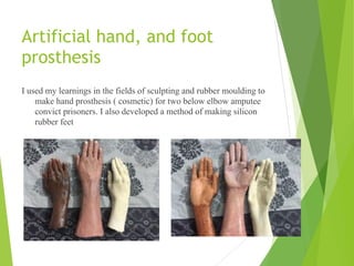 Artificial hand, and foot
prosthesis
I used my learnings in the fields of sculpting and rubber moulding to
make hand prosthesis ( cosmetic) for two below elbow amputee
convict prisoners. I also developed a method of making silicon
rubber feet
 