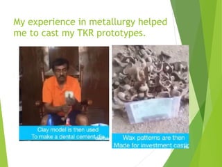 My experience in metallurgy helped
me to cast my TKR prototypes.
 