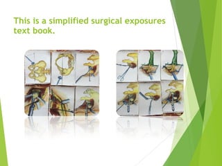 This is a simplified surgical exposures
text book.
 