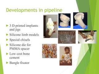 Developments in pipeline
! 3 D printed implants
and jigs
! Silicone limb models
! Special chisels
! Silicone die for
PMMA spacer
! Low cost bone
cement
! Bangle fixator
 