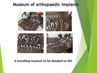 Museum of orthopaedic implants
A travelling museum to be donated to IOA
 