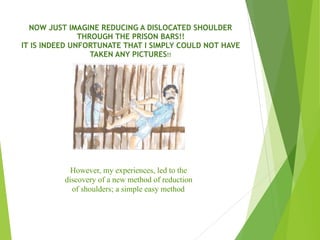NOW JUST IMAGINE REDUCING A DISLOCATED SHOULDER
THROUGH THE PRISON BARS!!  
IT IS INDEED UNFORTUNATE THAT I SIMPLY COULD NOT HAVE
TAKEN ANY PICTURES!! 
However, my experiences, led to the
discovery of a new method of reduction
of shoulders; a simple easy method
 