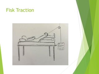 Fisk Traction
 