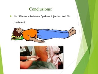 Conclusions:
! No difference between Epidural injection and No
treatment
 