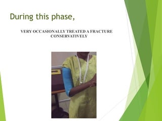 During this phase,
VERY OCCASIONALLY TREATED A FRACTURE
CONSERVATIVELY
 
