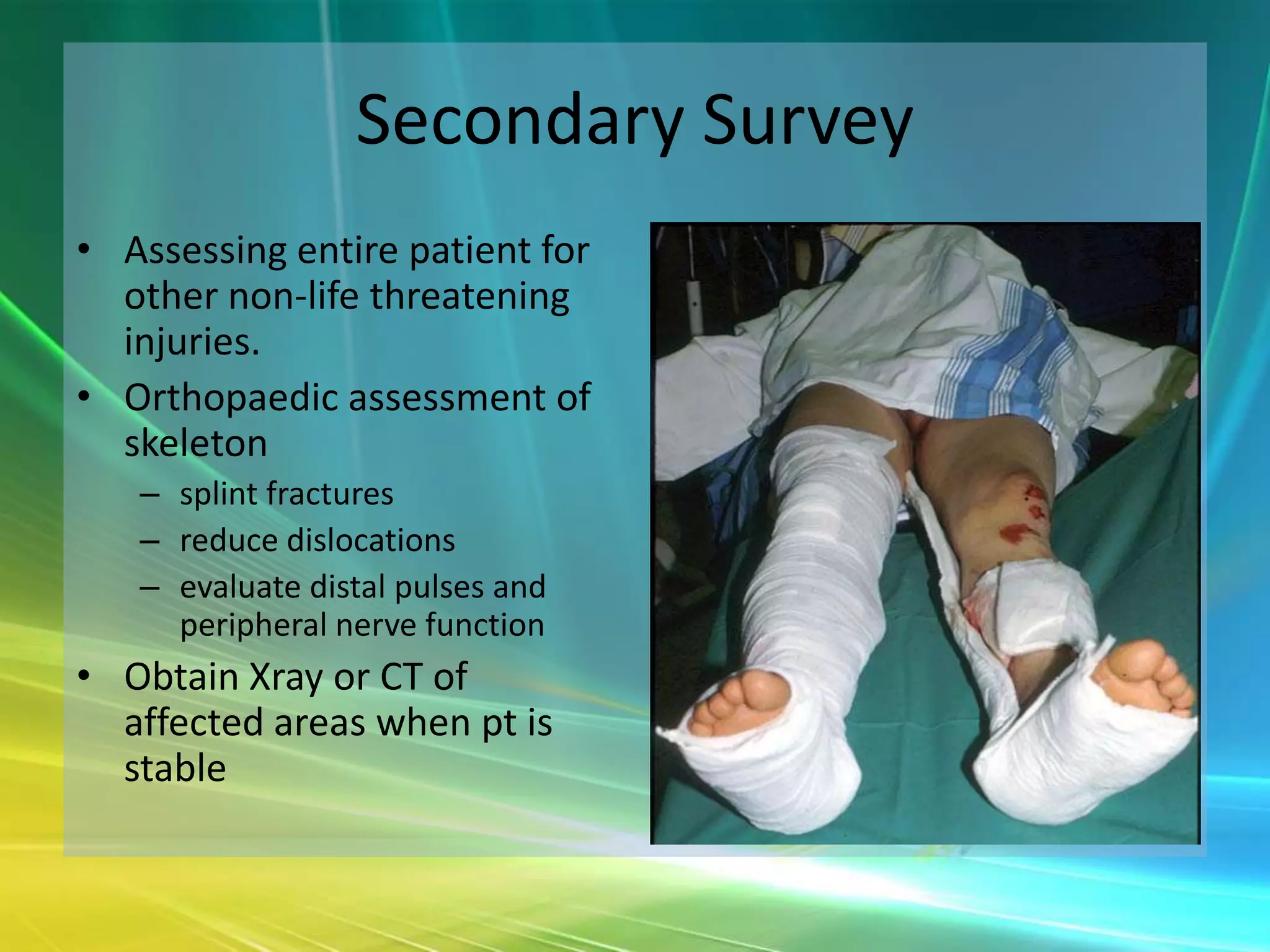 Secondary Survey
• Assessing entire patient for
  other non-life threatening
  injuries.
• Orthopaedic assessment of
  skeleton
   – splint fractures
   – reduce dislocations
   – evaluate distal pulses and
     peripheral nerve function
• Obtain Xray or CT of
  affected areas when pt is
  stable
 