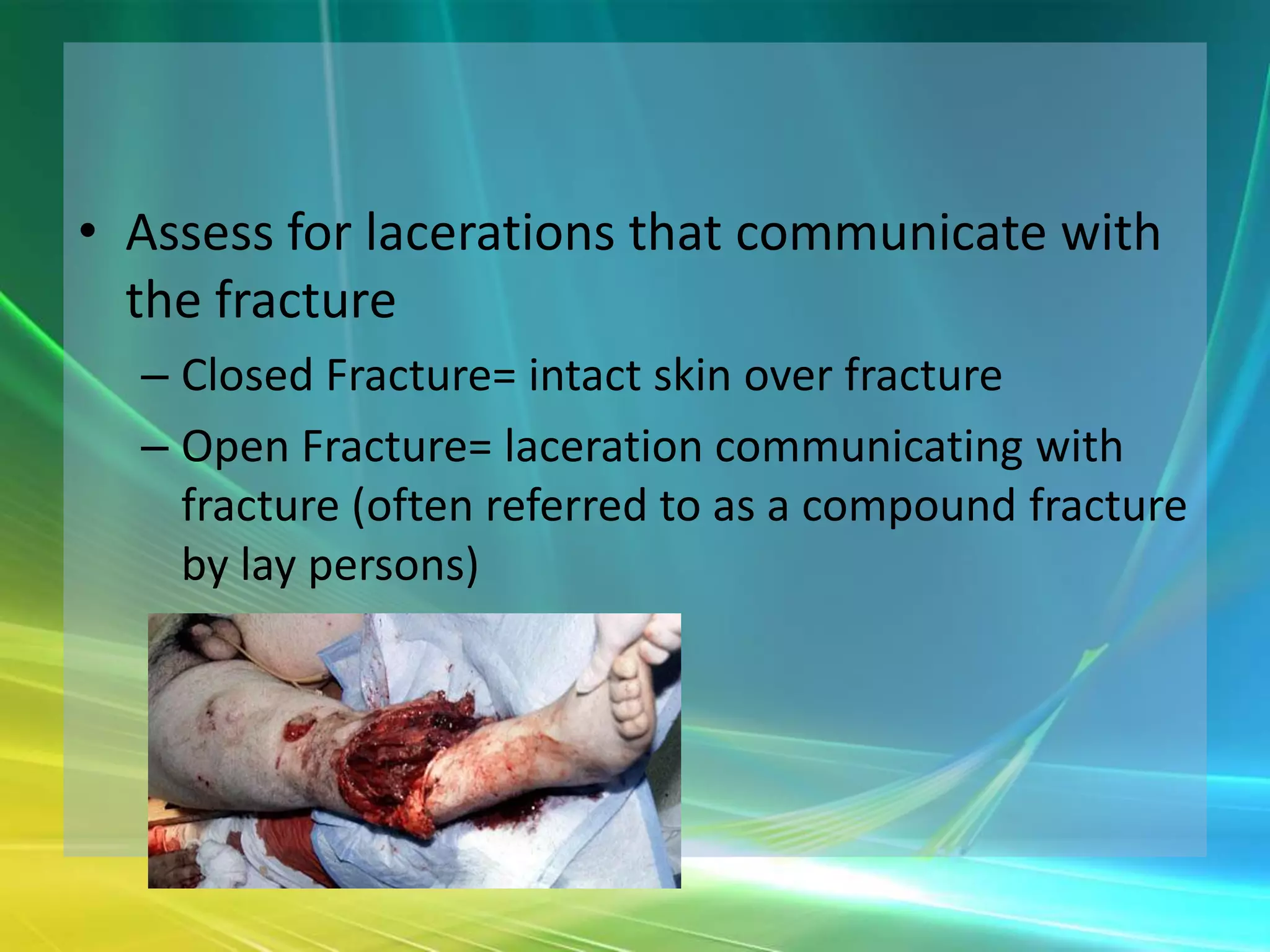• Assess for lacerations that communicate with
  the fracture
  – Closed Fracture= intact skin over fracture
  – Open Fracture= laceration communicating with
    fracture (often referred to as a compound fracture
    by lay persons)
 