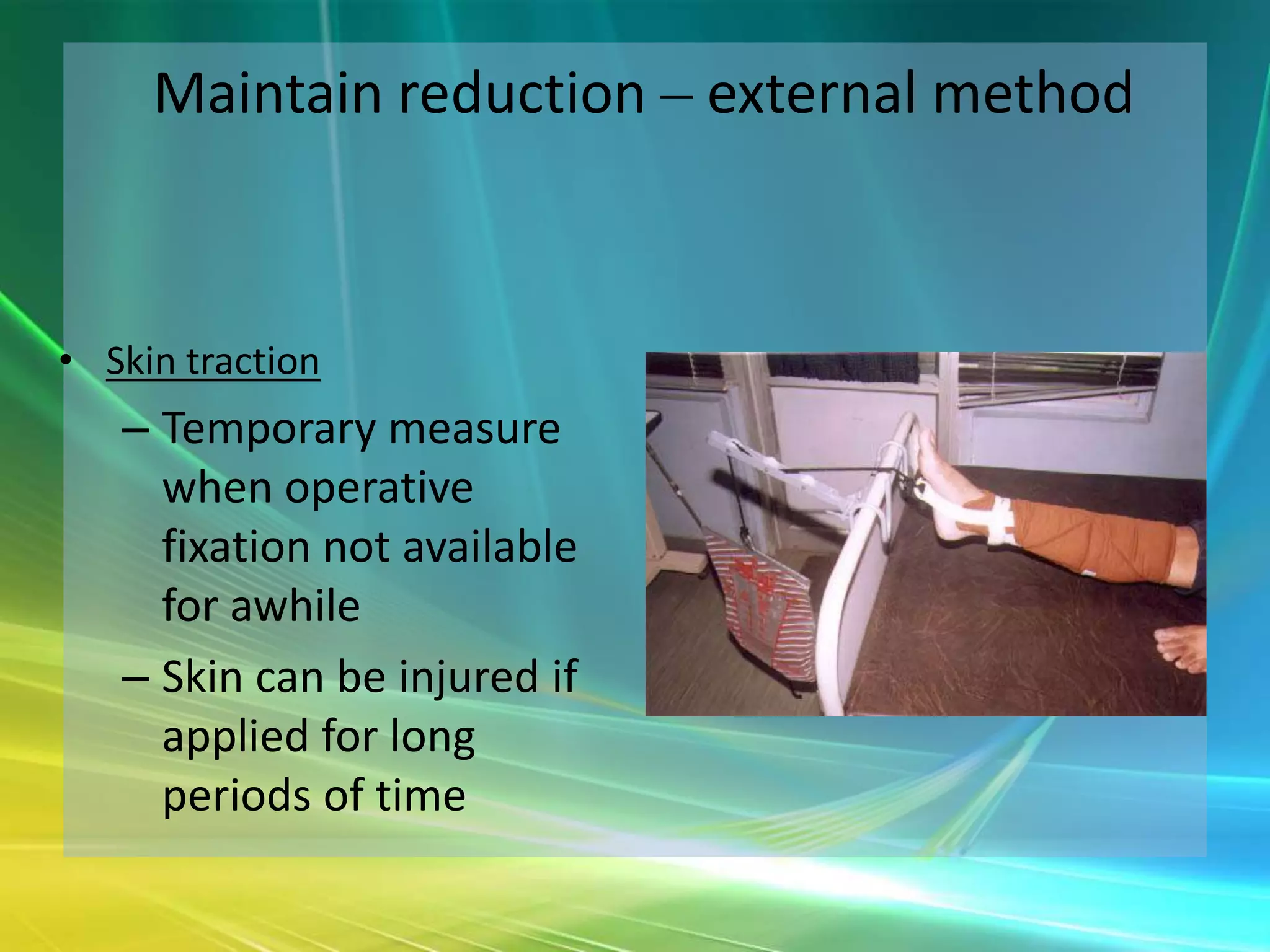 Maintain reduction – external method



• Skin traction
   – Temporary measure
     when operative
     fixation not available
     for awhile
   – Skin can be injured if
     applied for long
     periods of time
 