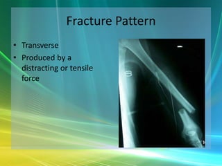 Orthopaedic Trauma - The Basics | PPTX