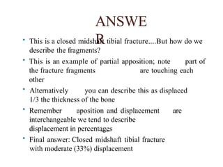 Partial Apposition Common Orthopaedic radiology slides part 1 | PPTX
