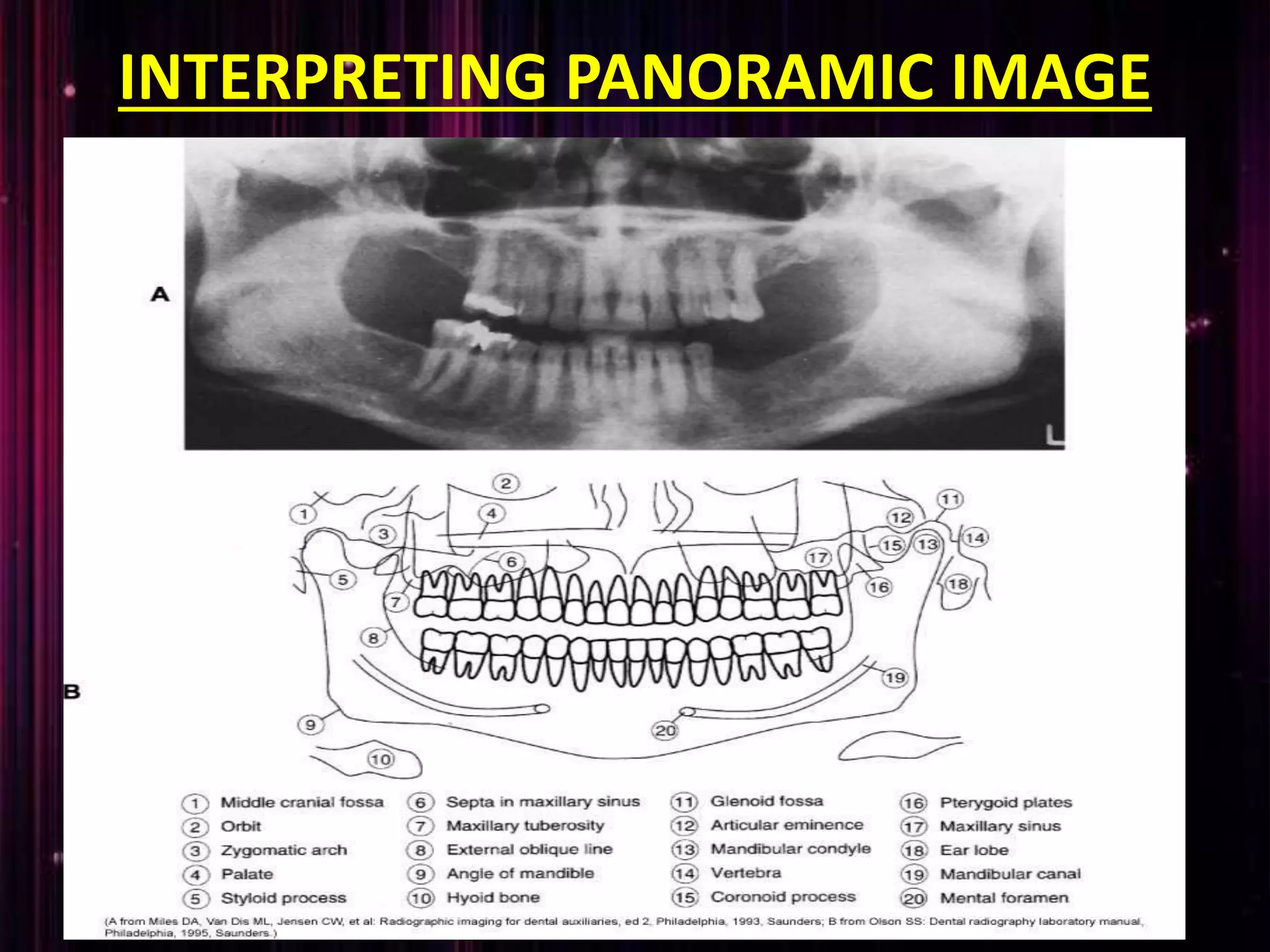 INTERPRETING PANORAMIC IMAGE
 