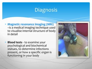 Diagnosis

Magnetic resonance imaging (MRI)
–is a medical imaging technique used
to visualise internal structure of body
in detail

Blood tests - to examine your
psychological and biochemical
statues, to determine infections
present, or how a specific organ is
functioning in your body
 