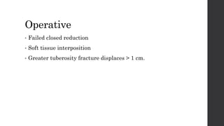 Operative
• Failed closed reduction
• Soft tissue interposition
• Greater tuberosity fracture displaces > 1 cm.
 