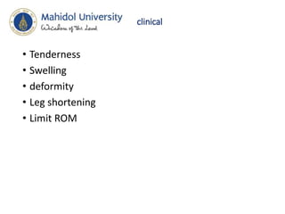clinical
• Tenderness
• Swelling
• deformity
• Leg shortening
• Limit ROM
 
