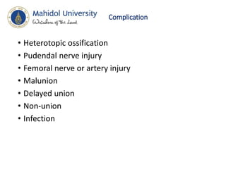 Complication
• Heterotopic ossification
• Pudendal nerve injury
• Femoral nerve or artery injury
• Malunion
• Delayed union
• Non-union
• Infection
 
