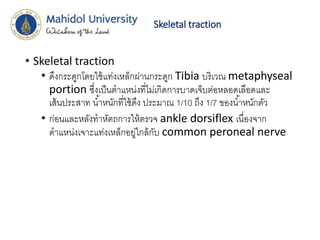 Skeletal traction
• Skeletal traction
• ดึงกระดูกโดยใช้แท่งเหล็กผ่านกระดูก Tibia บริเวณ metaphyseal
portion ซึ่งเป็นตาแหน่งที่ไม่เกิดการบาดเจ็บต่อหลอดเลือดและ
เส้นประสาท น้าหนักที่ใช้ดึง ประมาณ 1/10 ถึง 1/7 ของน้าหนักตัว
• ก่อนและหลังทาหัตถการให้ตรวจ ankle dorsiflex เนื่องจาก
ตาแหน่งเจาะแท่งเหล็กอยู่ใกล้กับ common peroneal nerve
 