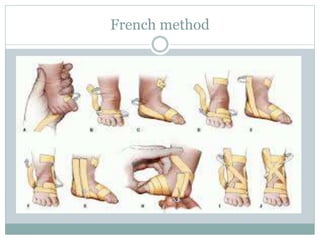 Orthopedic disorders in children | PPTX