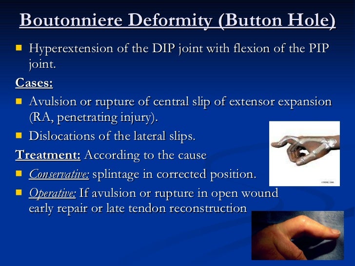 Orthopedics 5th year, 5th lecture (Dr. Ariwan)