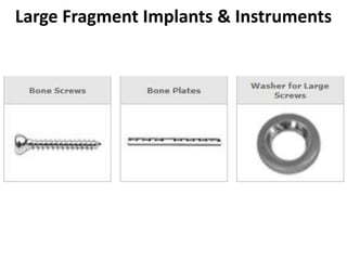 Large Fragment Implants & Instruments