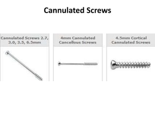 Cannulated Screws