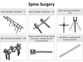 Spine Surgery