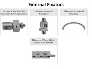 External Fixators