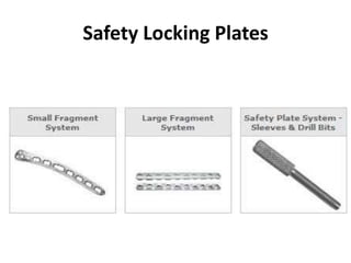 Safety Locking Plates