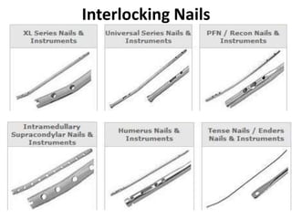 Interlocking Nails