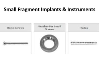 Small Fragment Implants & Instruments