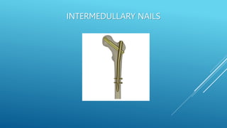 INTERMEDULLARY NAILS
 