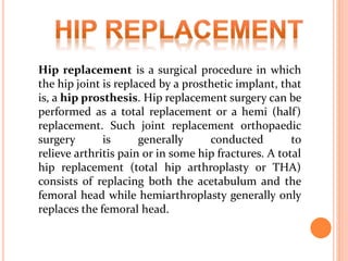 Hip replacement is a surgical procedure in which
the hip joint is replaced by a prosthetic implant, that
is, a hip prosthesis. Hip replacement surgery can be
performed as a total replacement or a hemi (half)
replacement. Such joint replacement orthopaedic
surgery is generally conducted to
relieve arthritis pain or in some hip fractures. A total
hip replacement (total hip arthroplasty or THA)
consists of replacing both the acetabulum and the
femoral head while hemiarthroplasty generally only
replaces the femoral head.
 