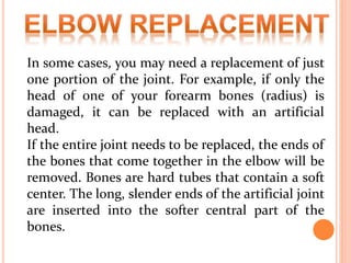 In some cases, you may need a replacement of just
one portion of the joint. For example, if only the
head of one of your forearm bones (radius) is
damaged, it can be replaced with an artificial
head.
If the entire joint needs to be replaced, the ends of
the bones that come together in the elbow will be
removed. Bones are hard tubes that contain a soft
center. The long, slender ends of the artificial joint
are inserted into the softer central part of the
bones.
 