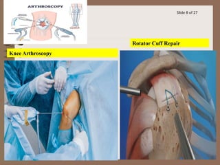 Comprehensive Overview of Orthopedic Procedures and Subspecialties | PPTX