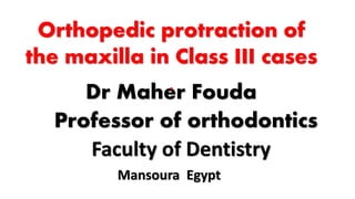 Faculty of Dentistry
Mansoura Egypt
Dr Maher Fouda
Professor of orthodontics
Orthopedic protraction of
the maxilla in Class III cases
.
 