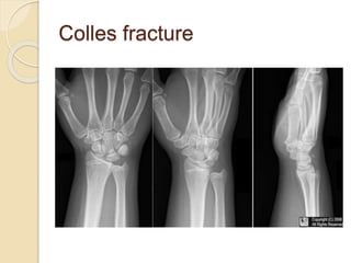 Orthopedics | PPTX