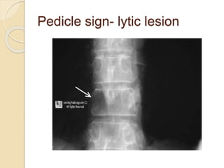 Orthopedics | PPTX