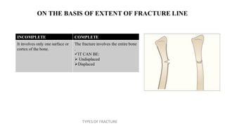 Orthopedics - All Types of Fractures.pdf
