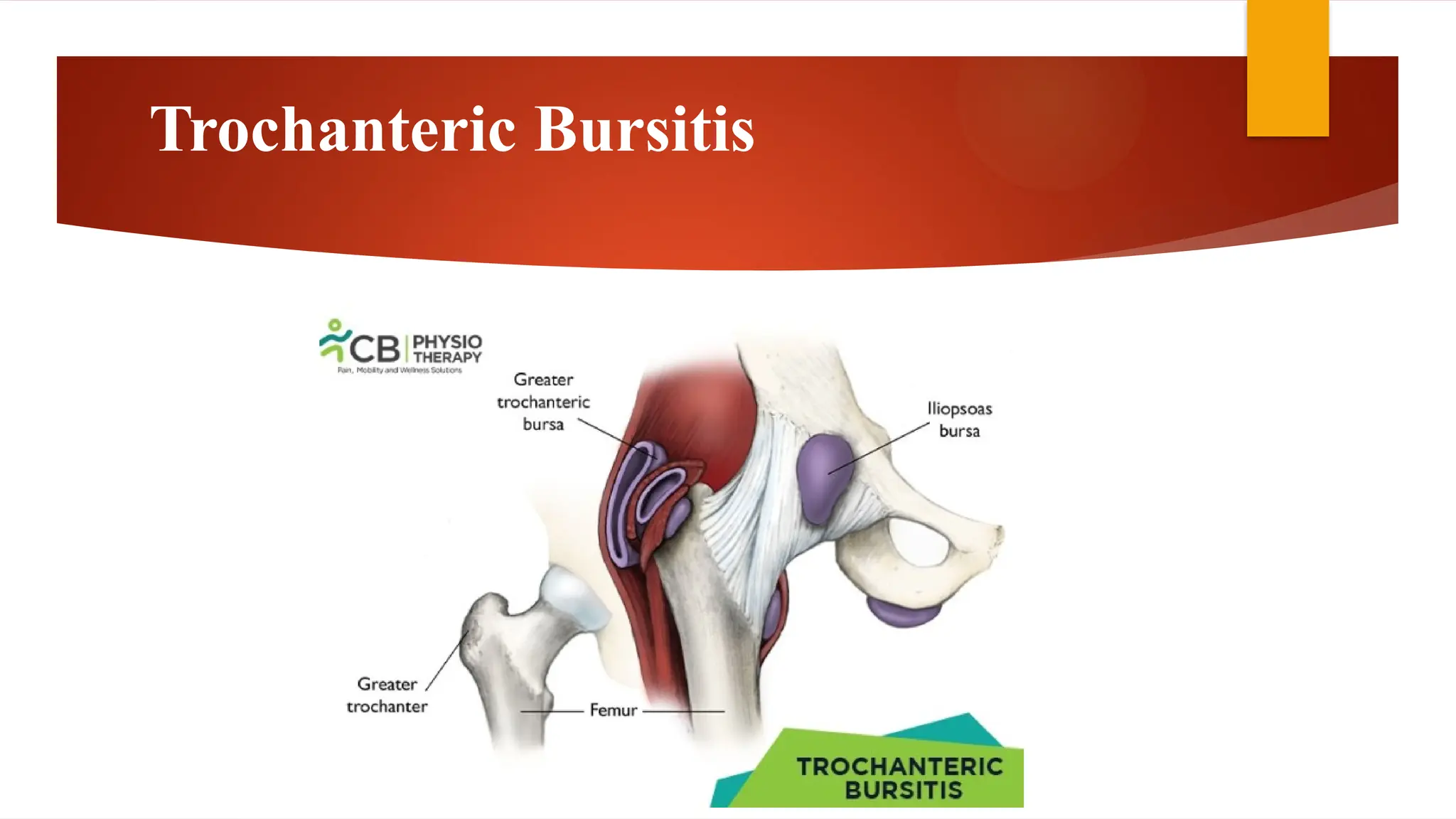 ORTHOPEDICS CONDITIONS OF HIP JOINT.pptx