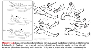 Mcmurray Testing Orthopedics clinical trainig and practice.pptx