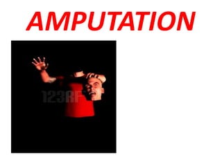 AMPUTATION
 
