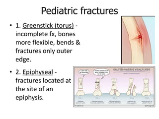 Pediatric fractures
• 1. Greenstick (torus) -
incomplete fx, bones
more flexible, bends &
fractures only outer
edge.
• 2. Epiphyseal -
fractures located at
the site of an
epiphysis.
 