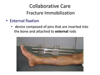 Collaborative Care
Fracture Immobilization
• External fixation
• device composed of pins that are inserted into
the bone and attached to external rods
 