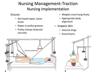 Nursing Management-Traction
Nursing Implementation
Ensure:
• No frayed ropes, loose
knots
• Ropes in pulley grooves
• Pulley clamps fastened
securely
• Weights must hang freely
• Appropriate body
alignment
– Inspect skin
• Around slings
• Around pins
 