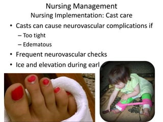 Nursing Management
Nursing Implementation: Cast care
• Casts can cause neurovascular complications if
– Too tight
– Edematous
• Frequent neurovascular checks
• Ice and elevation during early phase
 