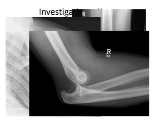 Investigations- Xrays
 