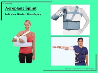 Aeroplane Splint
Indication: Brachial Plexus Injury
 