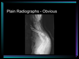 Plain Radiographs - Obvious

 